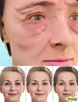 Crema aclaradora de manchas blanqueadoras