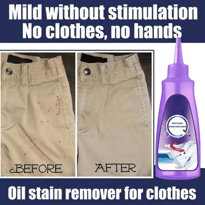 (🔥HOT SALE NOW 49% OFF) - Active Enzyme Laundry Stain Remover