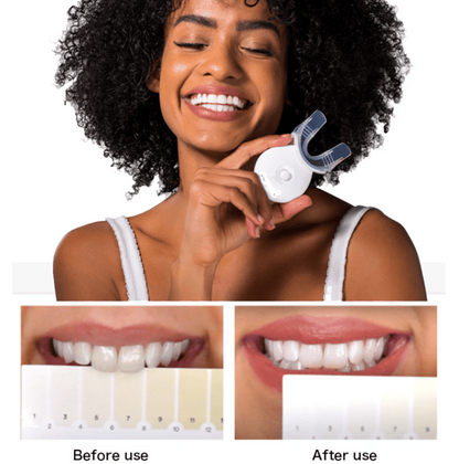 Kit de blanchiment des dents - Souriez en toute confiance😀