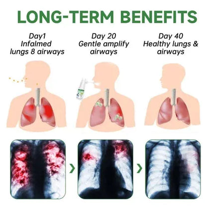 🔥Buy 1 Get 1 Free- RESPICLEAN™️ Herbal Lung and Breath Spray