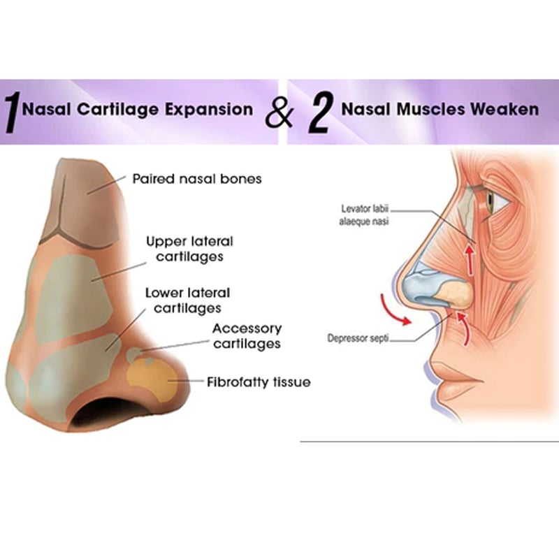 Nose Sculpting Device