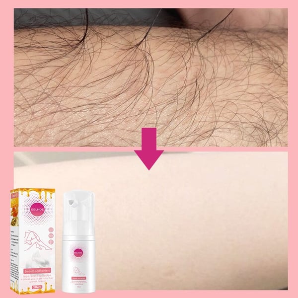 🔥Hot Sales✨Smooth as Honey: Mousse Hair Removal Spray