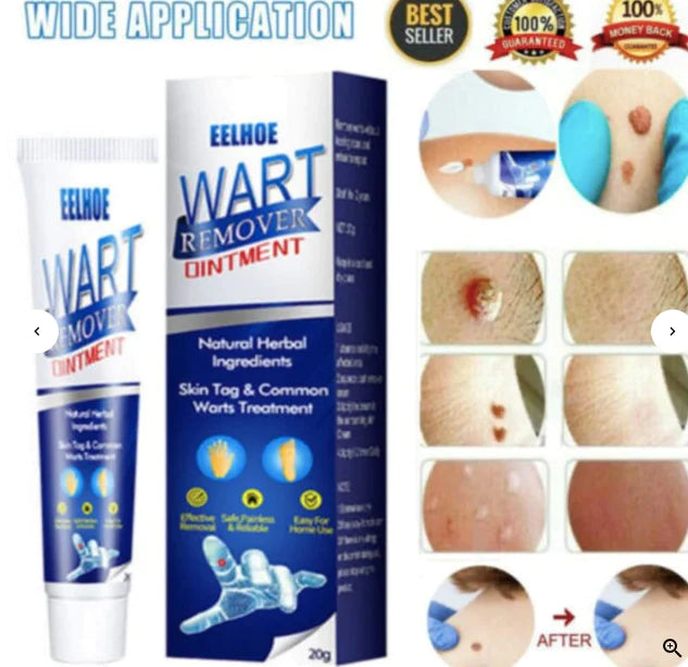 WART REMOVER GEL