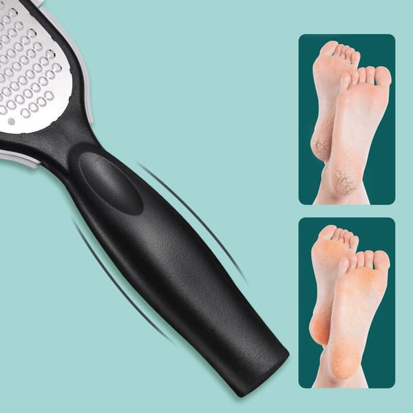 🎁2024-Christmas Hot Sale🎁🔥 49% OFF🔥Pedicure Knife Foot Sharpeners