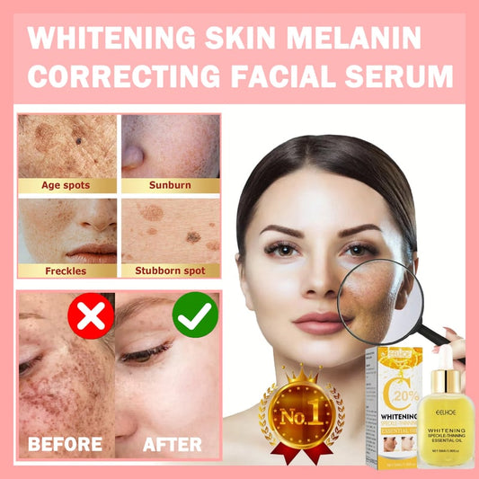 💥Mother's Day Hot Sale - Whitening Skin Melanin Correcting Facial Serum [Experience Flawless Skin, Starting Here!!!]