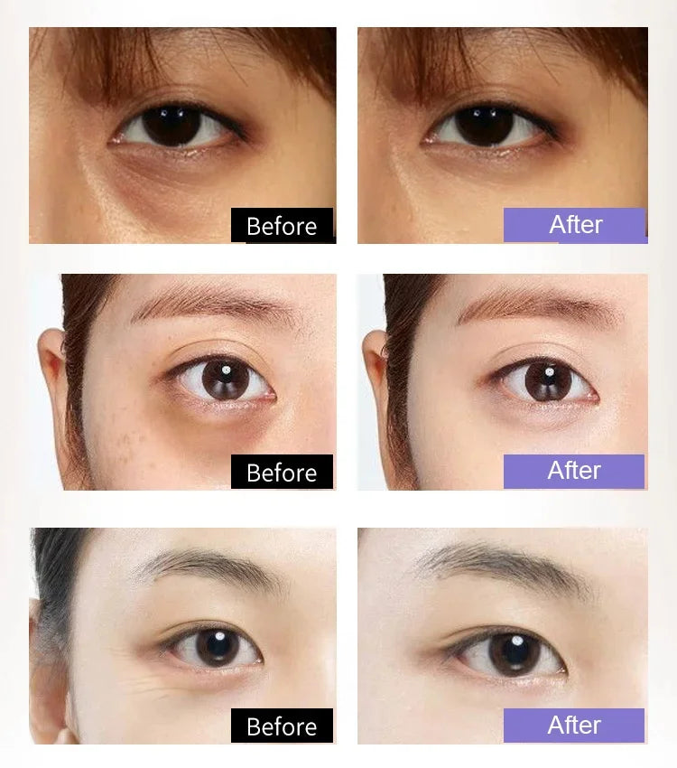 Firming anti wrinkle whitening eye cream