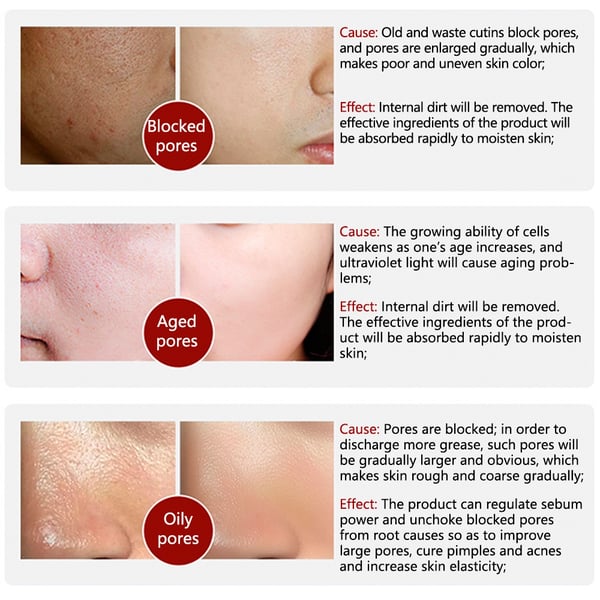 (💥BUY 2 GET 2 FREE⏰) 2024 New Magical Pore Eraser Waterproof Face Primer Stick